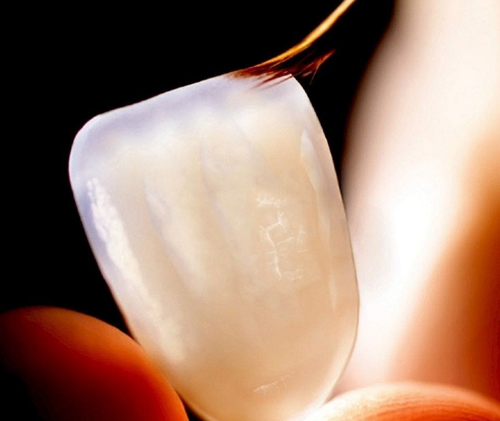 티 나지 않는 심미보철로 만족도가 높은 서울퍼펙트치과