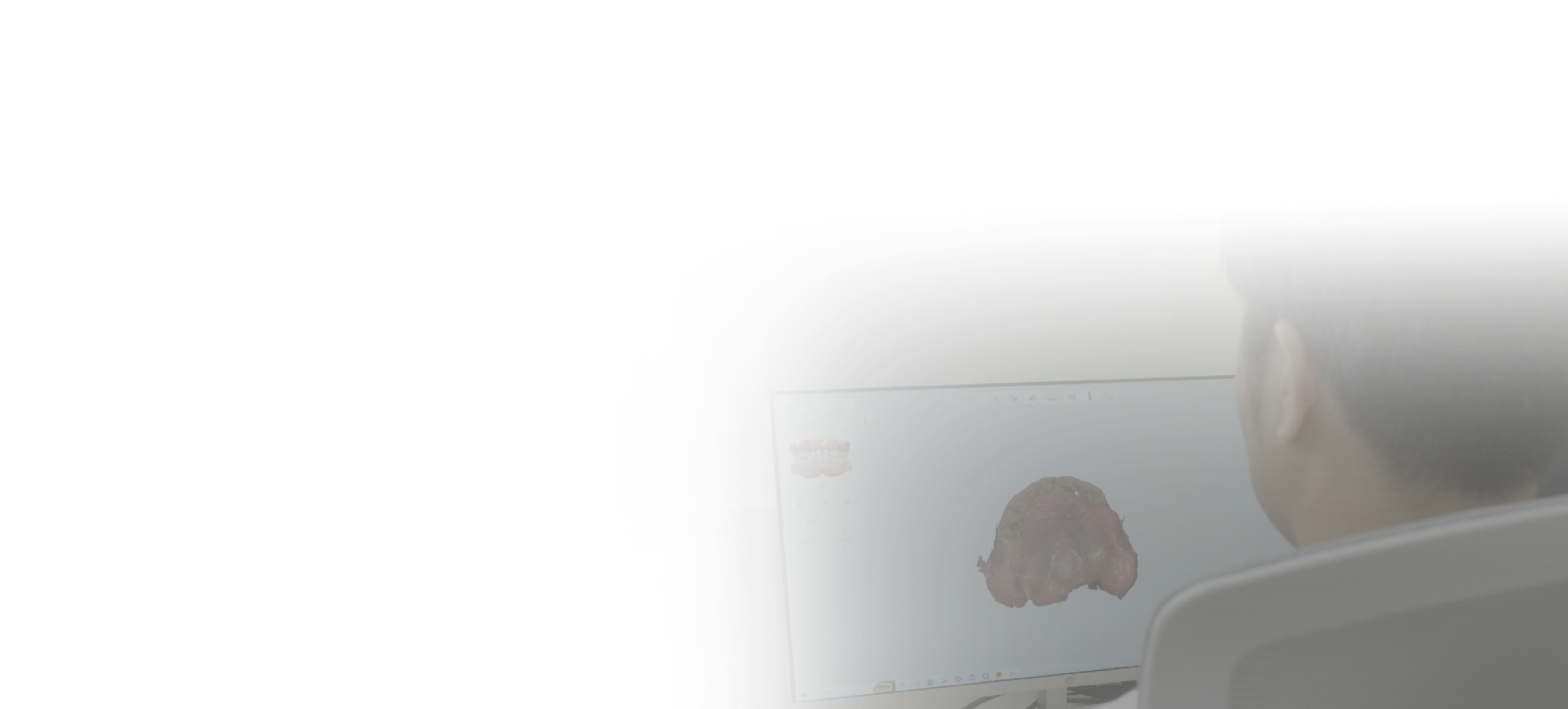 수준 높은 보철물 제작